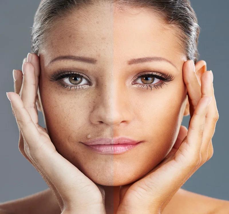 Understanding Your Skin: Dry vs. Oily, and How to Take Care of Both!