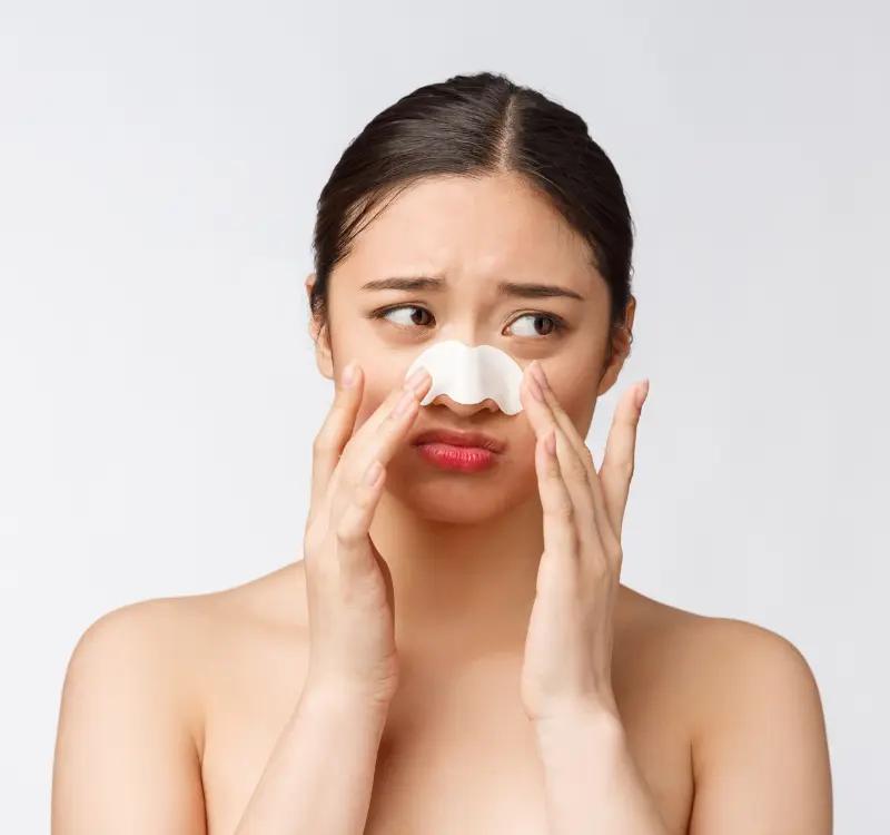 Black Heads vs Whiteheads, Home Remedies and Causes