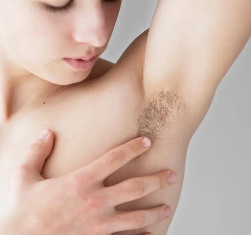 5 Main Causes of Itchy Underarms and Armpit Rashes and 5 Home Remedies to Reduce It